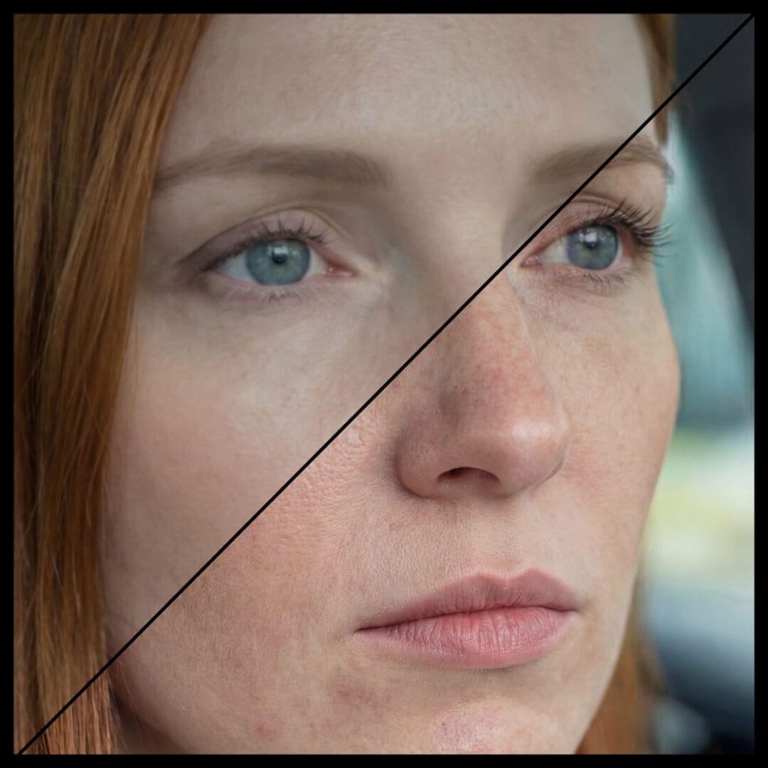 Side-by-side comparison of a female face, with one side edited for smoother skin and the other showing natural texture.